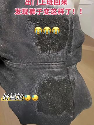 这条裤子也太显瘦了吧!!姐妹们! 穿上之后真的巨显瘦!而且它是那种宽松直筒的设计,所以特别藏肉,不管你是大腿粗还是小腿粗,或者是说肚子上有肉的,都可以放心去穿它,真的超级好看又百搭的一条裤子#裤子#百搭裤子#显瘦裤子#显高显瘦显腿长#女装穿搭