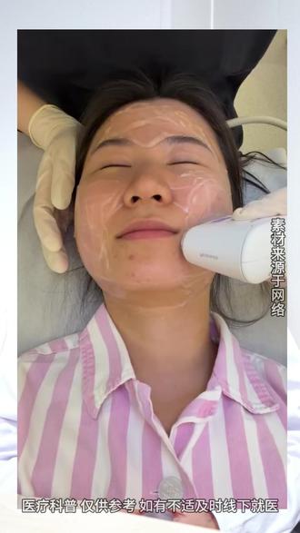 做完超声炮后,多久可以按摩面部 #超声炮 #八大处超声炮 #八大处孙恒赟 #超声炮效果