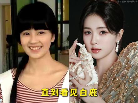 直到看见#白鹿 整容式的逆袭才明白,当年她为什么会说出这段话。2018 年#吴谨言凭借《延禧攻略》一炮而红。跨年晚会上,她身穿一袭高定礼服与聂远、许凯稳站第一排,风光无限。而身后的白鹿还是无人问津的小演员,全程穿着一套舞蹈服,待到结束大合照环节,也只能站在吴谨言身后当个背景板。到了 2019 年,白鹿终于有了独自走红毯的机会。她一身古典印花长裙,搭配廉价的耳坠。最关键的是一身黑黄的皮肤,一点女明星的气质都没有。此时的白鹿,说她是十八线演员也不为过。到了第二年,白鹿出席头条颁奖,终于穿了一件大牌礼服。唯一遗憾的是,这件礼服唐艺昕已经穿过了,还搭配了宝格丽珠宝,两人同框,谁的咖位更高一目了然。老板于正看在眼里,立即为白鹿升级了造型团队。没想到的是,白鹿好不容易接了个珠宝代言,又因为体态不好被骂上热搜。网友说她站姿奇怪,像在憋尿,还拿她跟汤姆猫做比较。在电视剧《以爱为营》中,白鹿扮演的是倾国倾城的大美女角色。但是因为体态不好,把剧中的各种高奢大牌穿得像微商女强人,一身红色小香风套装,穿得膀大腰圆五五分。颜值不够全靠台词尬吹美貌。面对铺天盖地的舆论,白鹿咬牙蜕变,一边打磨演技,一边坚持护肤。多年后,当白鹿再度站上红毯,众人惊叹于她的改变,从之前的疲态寡相脸,到现在的神采奕奕。她用实力打破偏见,更证明普通女孩无需动刀,也能靠自律与坚持,美出新高度!!!#韦雪#胶原灌注面膜#好物推荐🔥