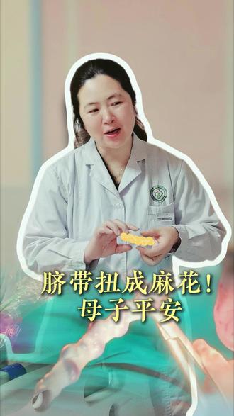 脐带扭成麻花,母子平安 #产科蒋小芒医生 #脐带扭转 #母婴平安