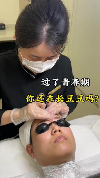 过了青春期,你还在长痘痘吗?#蚌埠 #黑头 #痘痘反复