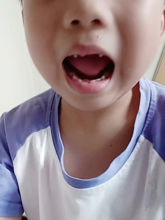 看过来 ,神兽换牙