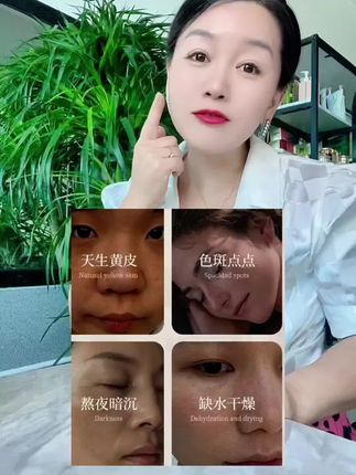 #肤研美白淡斑套盒 主打淡斑,色斑 晒斑 雀斑 老年斑 产后斑 一定要试试这个#肤研美白淡斑精华液 #肤研美白精华液 #淡化斑点 #美白淡斑