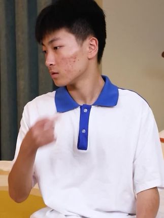 【仁和】草本祛痘膏,专抹各种痘痘,痘印,痘坑,粉刺,黑头