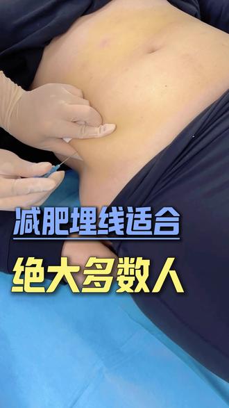减肥埋线适合那类人群 #产后恢复 #减肥埋线 #抖出健康知识宝藏 #健康科普破圈计划 #人间观察计划