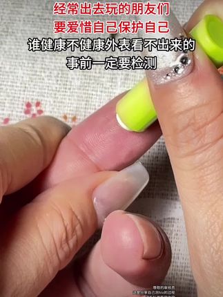 经常出去玩的朋友们,要珍惜自己保护自己,谁健康不健康有时真的看不出来,事前花十五分钟让对方测一下这个很有必要#谈恋爱 #异地恋 #奔现 #情侣 #感染四项