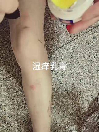 湿痒乳膏#橱窗有好物推荐#自用好物推荐