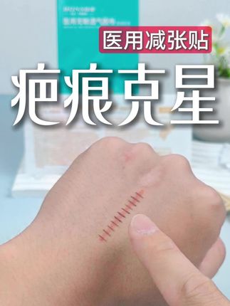 医用减张贴疤痕修复的好帮手 #医用减张贴 #减张贴 #疤痕增生 #疤痕遮盖