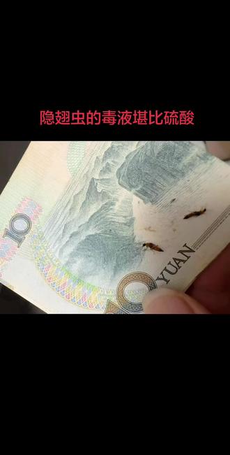 隐翅虫(鞘翅目隐翅虫科),又名影子虫、青腰虫;多数细长5–10 mm,鞘翅短仅盖胸,后翅折叠隐藏,外形常像会飞的蚂蚁;中国常见有毒种类为梭毒隐翅虫(红黑相间),全球超6.6万种,绝大多数无毒且是益虫(捕食蚜虫、螨虫) 。习性与高发期
• 喜潮湿,昼伏夜出,极强趋光性,夏夜灯光下易飞入室内;夏秋季(尤其8–9月)为活跃高峰。
• 不咬人蜇人,只有虫体被拍碎/碾压时才释放pH 1–2的毒隐翅虫素引发皮炎。
隐翅虫皮炎症状
接触后数小时至1–2天出现条状/片状红斑、密集水疱/脓疱,伴剧烈灼痛、瘙痒;严重时糜烂、发热、淋巴结肿大;愈合后常留短暂色素沉着。
正确处置步骤
1. 虫落皮肤:严禁拍打!用嘴吹走、纸巾轻捏移除、胶带粘走。
2. 不慎接触毒液:立即用肥皂水/小苏打水反复冲洗10分钟中和酸性;避免搔抓;症状重(大面积水疱、眼黏膜接触)务必及时就医。
预防措施
• 夜间尽量少开强光,安装纱窗,关灯前关好门窗。
• 户外穿长袖衣裤,暴露部位涂驱虫剂;睡前检查床铺。
#隐翅虫#隐翅虫的毒液堪比硫酸