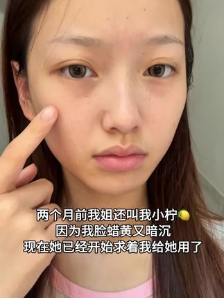 没想到一向只用大牌的人,也会向这两位数的#抗氧#美白精华 妥协 #护肤#轻松拥有好皮肤