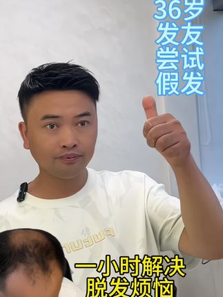 脱发十年,三十六岁发友尝试改变#合肥男士假发#安徽男士假发#头发稀疏#男士假发补发#全真发手工钩织