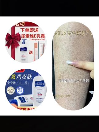 20%尿素霜医院专用维e乳霜500g补水保湿烟酰胺去鸡皮身体乳液正品#尿素霜 #维e乳霜 #去鸡皮
