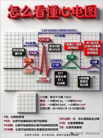 #心电图#临床技能考核