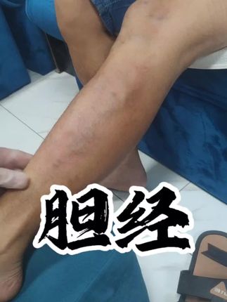 #拍痧#拍打#经络疏通古严陵#开穴通络小助手 #国学文化