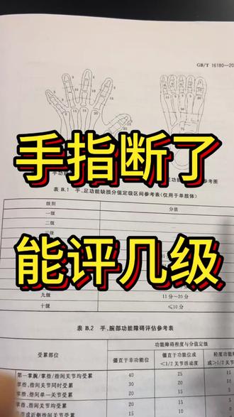 手指断了怎么评等级 #劳动能力鉴定 #工伤赔偿 #工伤认定 #湖北荆门工伤