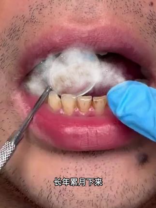 牙膏14牙膏口气清新,200%强力去渍,牙龈呵护超贴心!#居 牙膏14牙膏口气清新,200%强力去渍,牙龈呵护超贴心!#居家清洁 #口腔护理 #生活好物