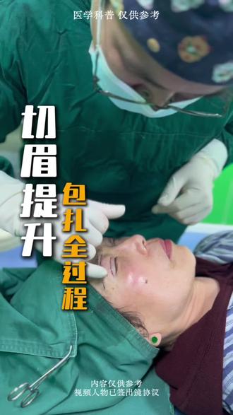 #切眉提升 包扎全过程#抖出健康知识宝藏 #切眉 #切眉手术 #双眼皮