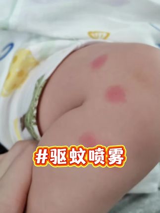 招蚊体质的宝宝孕妈们试试这个植物驱蚊喷雾#驱蚊#驱蚊喷雾#招蚊体质