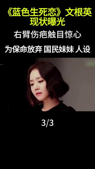 《蓝色生死恋》文根英现状曝光:右臂伤疤触目惊心,为保命放弃“国民妹妹”人设,这还是恩熙吗?#文根英 #恩熙 #蓝色生死恋