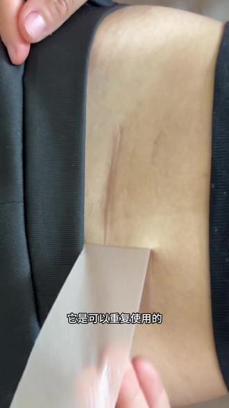 #疤痕修复 真心安利这款#仁和#医用硅酮疤痕贴!
不管是手术疤、磕碰留的印子,还是增生小疤痕都能用
医用级硅酮材质,温和不刺激,贴上轻薄隐形,日常穿衣、活动完全不硌肤,防水透气,洗澡不用撕,
不用频繁涂药膏,一贴搞定,懒人修复疤痕首选✨