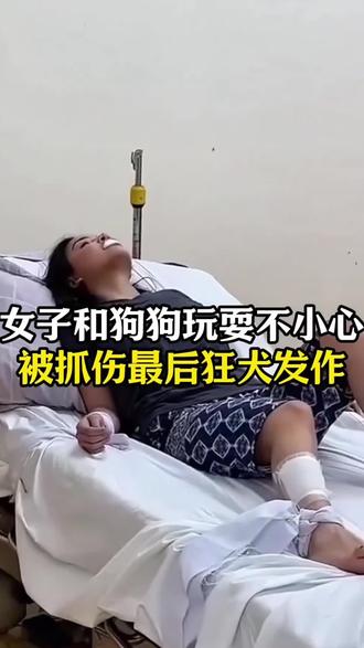 猫狗抓咬后,这些常识咱们一定要知道。#萌宠 #狂犬病 #科学养宠攻略 #宠物 #狂犬疫苗