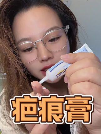 小恩在用的就是这款疤痕膏,是倍舒痕官方旗舰店的!疤痕膏一定要坚持涂哦,一支就够用很久了!#疤痕膏#疤痕护理#伤口#伤口缝合#疤痕增生