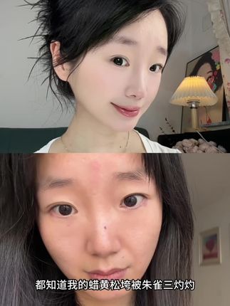 每天三分钟悄悄变美!#朱雀三啄#变美#养生#黄铜按摩器