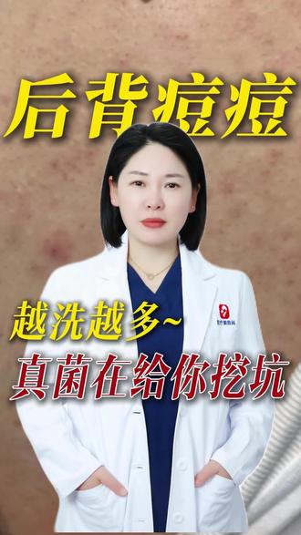 后背痘痘越洗越多?真菌在给你挖坑! #抖出健康知识宝藏#医疗健康创作训练营#抖音医学院 #后背痘痘 #真菌