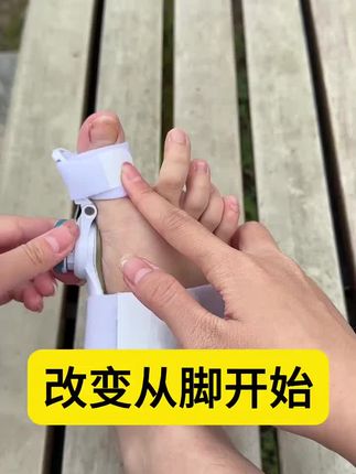坚持戴一段时间!#拇外翻#改善拇外翻#好物种草