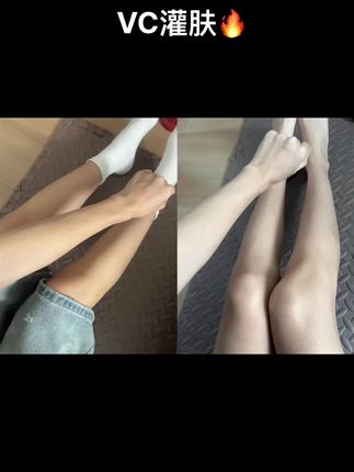 真的太牛了👍#美白 #VC #VC灌肤 #日常分享 #热门