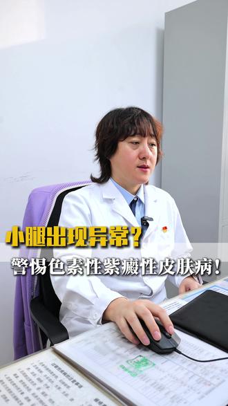 小腿出现异常?警惕色素性紫癜性皮肤病!#色素性紫癜性皮肤病 #医学科普 #皮肤问题