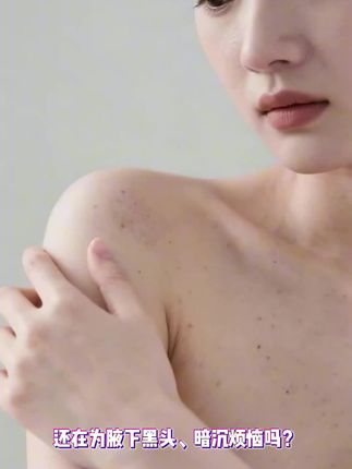 如果你的腋下也是这样,那就试试这个小东西,它里面富含维生素,可以有效改善腋下黑头、暗沉等问题,让你的腋下变得光滑细腻。而且它的质地很轻盈,一点也不油腻,用起来非常清爽,每天坚持使用,你一定会爱上它的。别再犹豫了,赶紧点击下方链接购买吧!