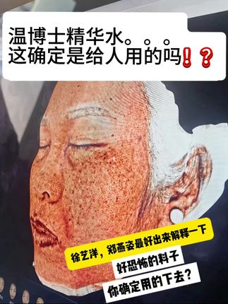 (拍一发九)活动福利大放送!!徐艺洋你也太会买了吧!跟着#徐艺洋 学湿敷,透亮光滑的小脸蛋就这么水灵灵的出来了,我怎么现在才发现这个#温博士b5精华水 #收缩毛孔 #护肤 H