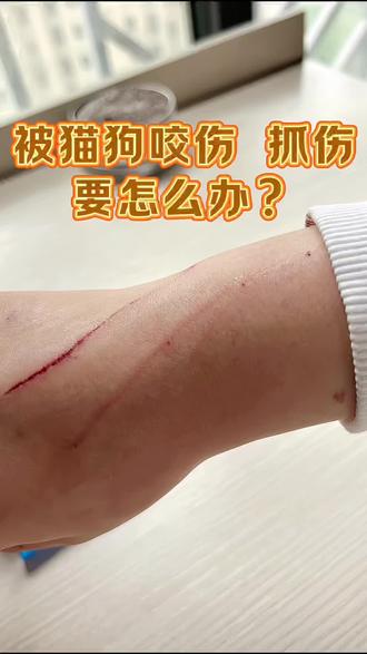猫咪狗狗抓伤咬伤注意哦,刚开始不知道就马上去打狂犬疫苗了,后来朋友说可以给猫咪做个狂犬抗原检测,他们家2个猫都检测过,推荐了这个狂犬抗原检测卡纸,家人们可以试试!#养猫知识#狂犬病#被猫抓伤#被猫狗抓伤#被猫抓伤一点要打疫苗吗
