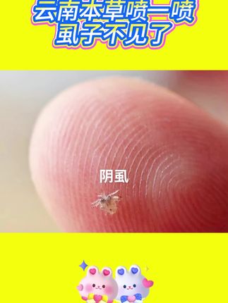 云南本草百部酊#虱子 #百部酊喷剂 #虱子卵 #虱子是怎么来的 #虱子克星