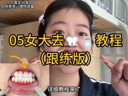 改🪭🦷周👀屌的法子(详细教程版)#牙周火火#黑三角#牙齿护理#牙龈未遂#百亿流量扶持计划