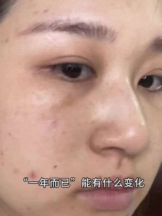 人的变化到底有多大呢….#自用好物分享 #精致女人必备 #亲测分享 #康恩贝 #变化