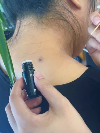 #宝藏好物 #脖子上的小肉粒 #好物种草