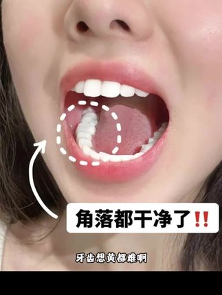 #爱牙护牙 #牙黄咋办 #口腔健康 #种草好物 #必备好物