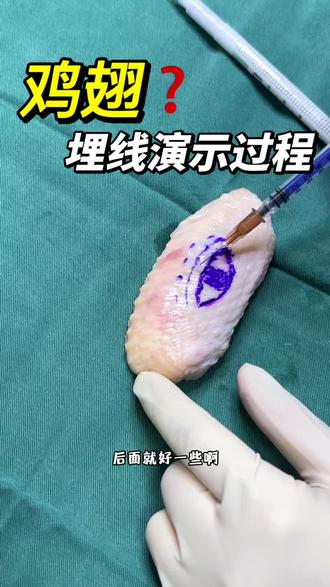 今天用鸡翅演示双眼皮埋线全过程~#创造者激励计划 #医学知识科普 #双眼皮埋线#埋线演示#沧州贺金秋