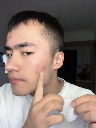 #男生护肤 #护肤分享 #水杨酸面膜