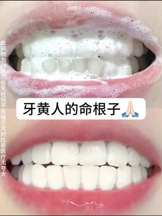 我自己用了快2周,被这支变色牙膏有的效果说服了!#美白牙膏#色修牙膏#浪漫高手#无限回购的宝藏单品#国货