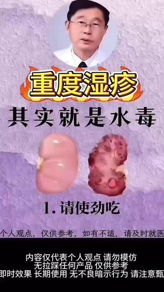 美容师私藏的精致指南!重度湿疹千万别碰这三样东西#湿疹#艾涵诺