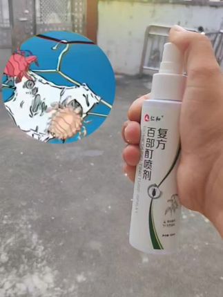 #头上有虱子怎么办 #虱子#头虱 #消除虱子卵的方法
