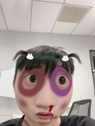 超级好用的行李箱轮子保护套,不仅能保护行李箱轮子,还能降低噪音,真是太好用了。#行李箱轮子保护套 #实用好物
