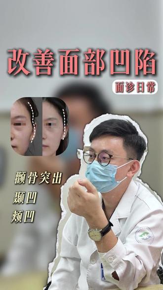 绝大多数亚洲女性的颧骨都会有些凸,年轻时还好,稍微上些年纪伴随颞骨凹陷和颊部凹陷,轮廓问题就会凸显出来,整个人的疲态和衰落感就会很明显,甚至有的看上去会有些刻薄,这个时候优先解决轮廓流畅问题是格外重要的#面部轮廓不流畅怎么改善 #上热门🔥