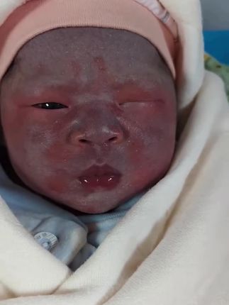 孕期都好好的,出来怎么这样,我和老公都不知道该怎么办了?