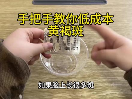 20s教会你淡化黄褐斑(详细教程)#雀斑#淡斑#黄褐斑#祛斑#平价护肤