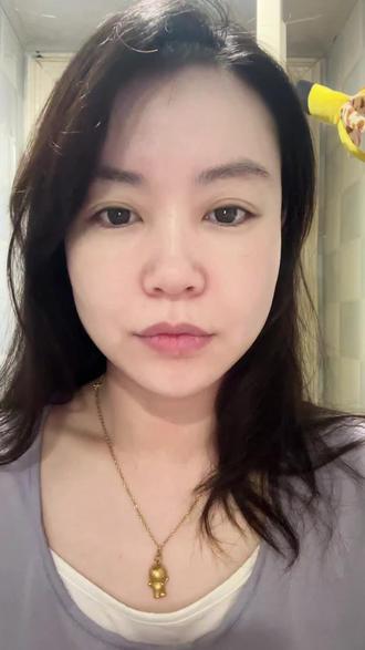 打卡 #凌博士次抛 第78天
#皱纹 #晚间护肤 #玻尿酸 #全分子玻尿酸