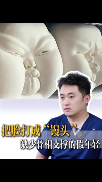面部注射物过多形成的馒化脸到底是什么?缺少骨相支撑!皮肉贴合!#馒化脸 #面部注射 #济南整形郭广科 #馒化脸怎么改善 #创作灵感